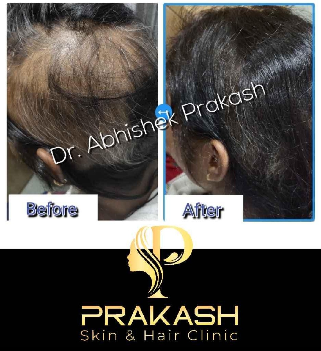 Treatment Result